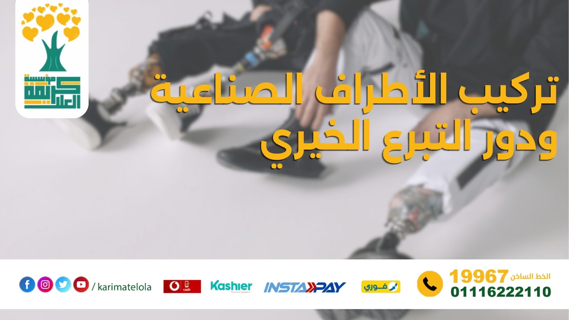 تركيب الأطراف: تركيب الأطراف الصناعية التكلفة والخطوات